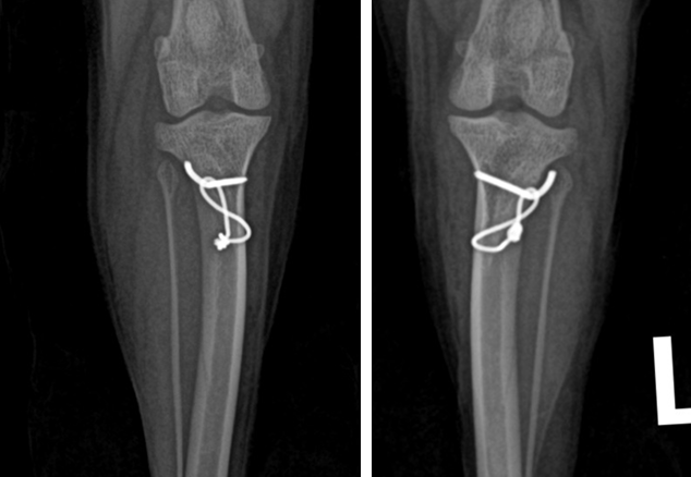 슬개골 탈구 수술후 X-ray 사진1