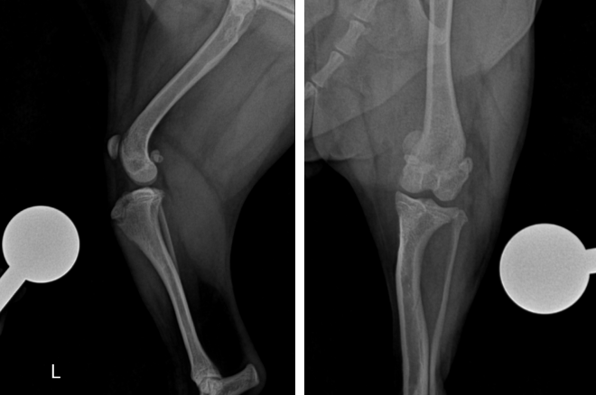 인공활차구(PGR) 수술전 X-ray 사진