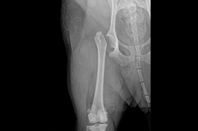고관절 이형성증에 의한 고관절탈구 수술(FHNO)후 X-ray 사진