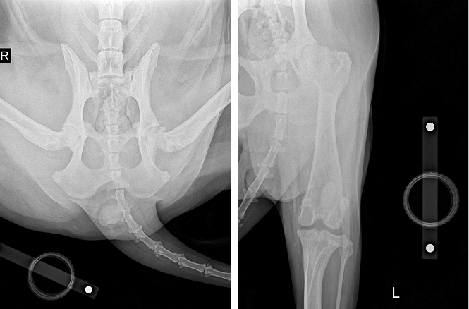 THR 수술전 X-ray 사진1