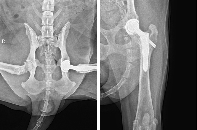 THR 수술후 X-ray 사진1