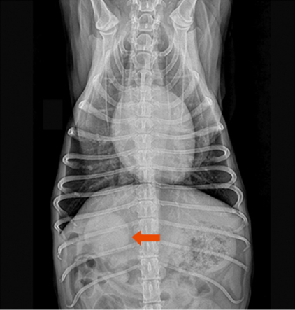 X-ray 촬영 및 원내 CT촬영으로 확인 된 폐종양1