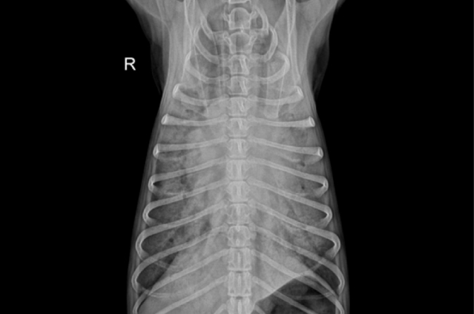 X-ray로 확인된 폐수종